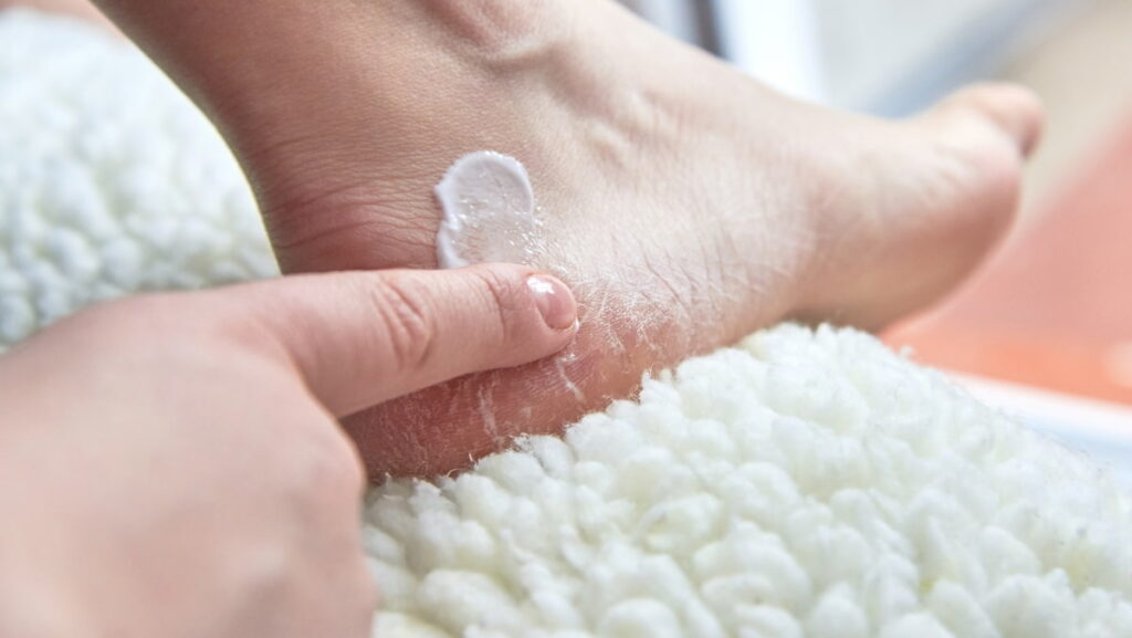 Dry Skin On Feet