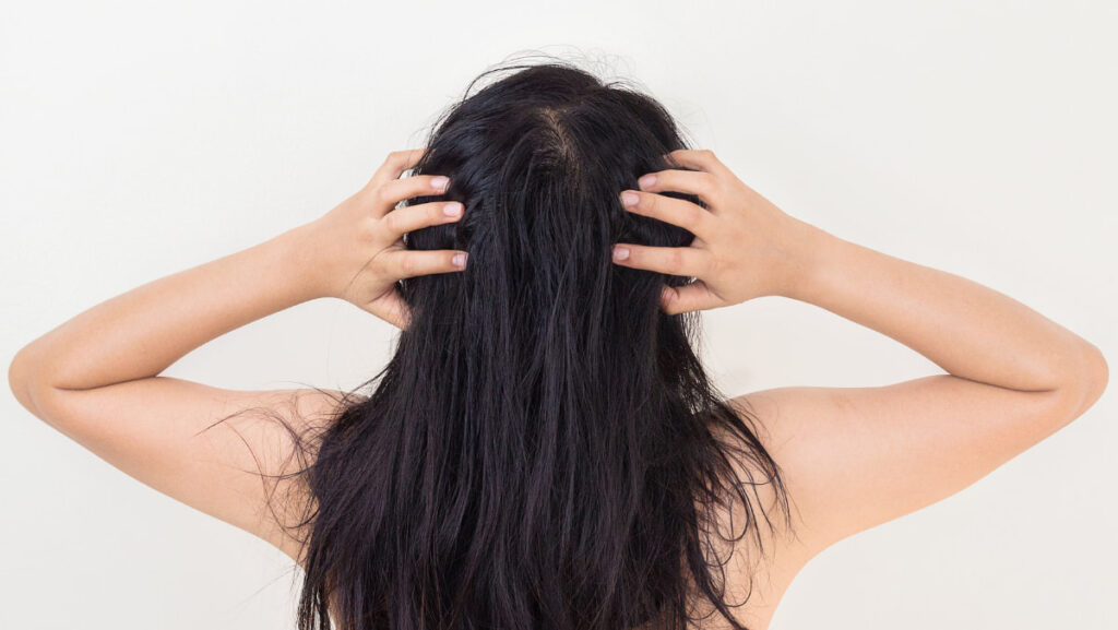 What Causes Dry Scalp