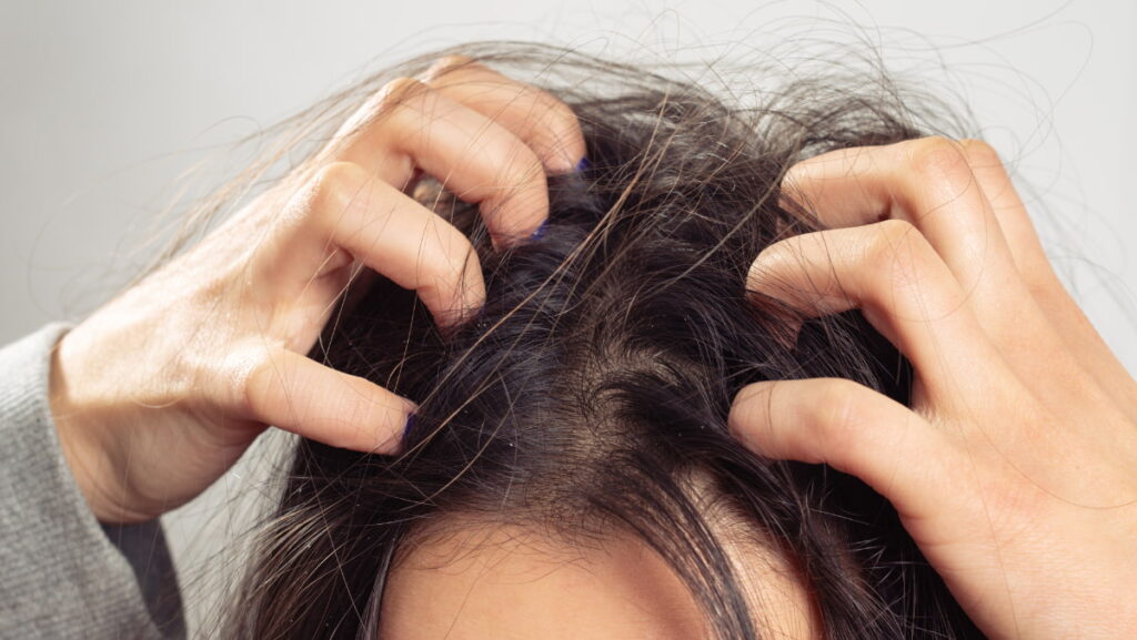 What Causes Dry Scalp