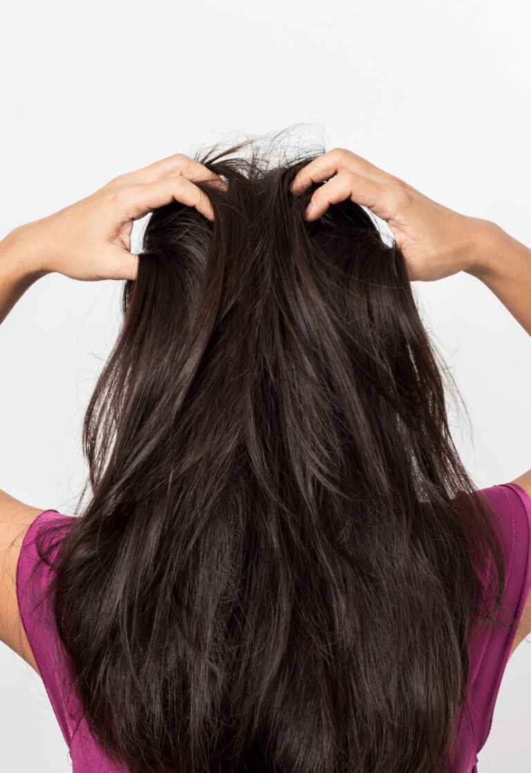 What Causes Dry Scalp? The Itchy Mystery Behind Your Hair Woes