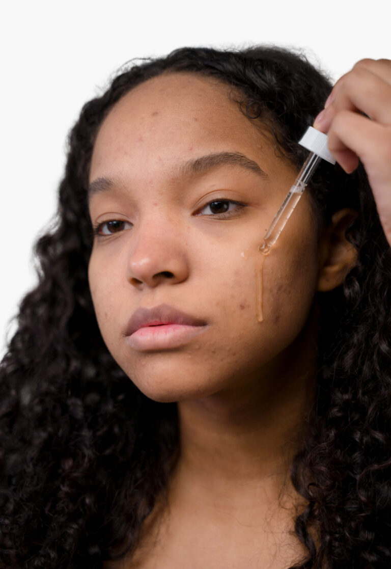Can Hyaluronic Acid Cause Acne: Interesting Studies Explain