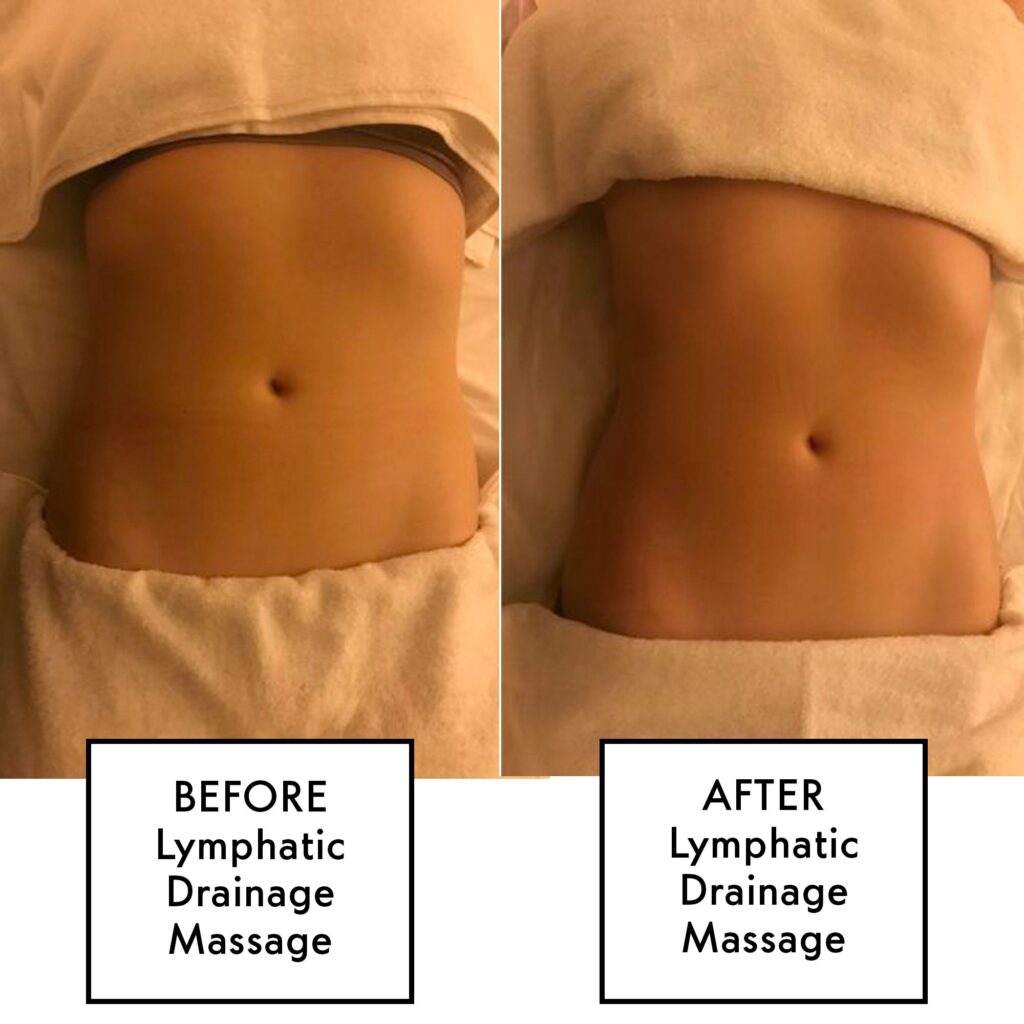 Brazilian Lymphatic Drainage Massage Before And After